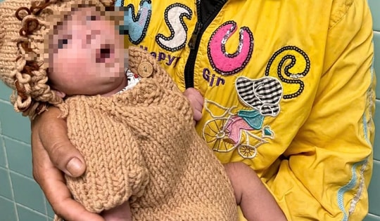 Trẻ sơ sinh 5 ngày tuổi bị thủng dạ dày vì mẹ cho ăn cơm: Cảnh báo sai lầm chết người khi chăm con nhỏ