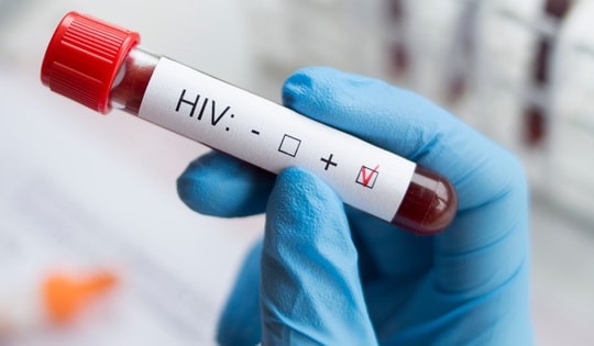 Cửa sổ huyết thanh có ý nghĩa gì trong xét nghiệm HIV?