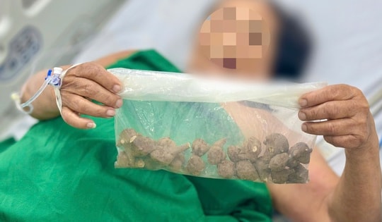 Đặt mua củ ấu tẩu trên mạng để chữa khớp, người phụ nữ suýt tử vong