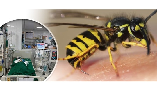 Cứu sống bé gái bị suy đa tạng do ong vò vẽ đốt