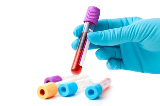 4 lầm tưởng về ung thư máu