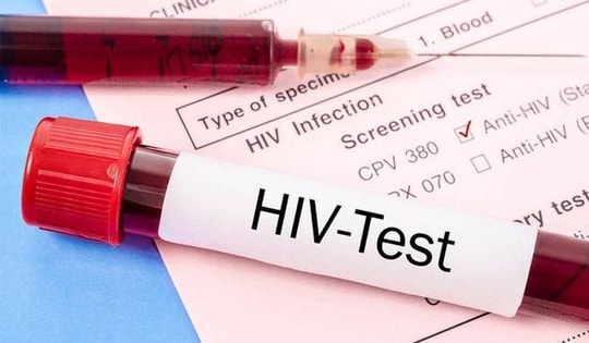Thực trạng HIV/AIDS ở Việt Nam: Dịch đã được kiểm soát nhưng chưa thể chủ quan