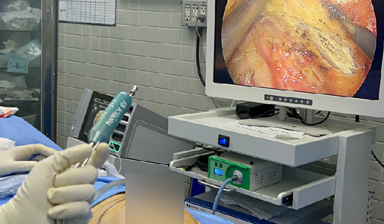 Ca phẫu thuật ít xâm lấn tái tạo vú đầu tiên ở người ghép thận tại Việt Nam