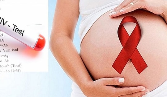 Những điều cần biết về chăm sóc bà mẹ có HIV ngay sau sinh