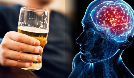 Uống mấy ly rượu mỗi ngày có thể tăng nguy cơ đột quỵ nghiêm trọng?