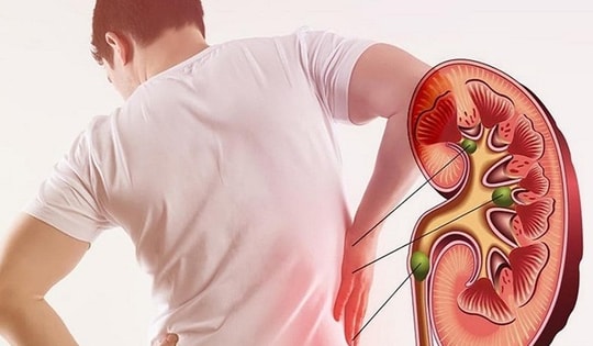 Người bệnh thận mạn tính cần thận trọng với những loại thuốc nào?