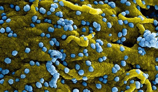 Ethiopia xác nhận 3 ca tử vong do virus Marburg