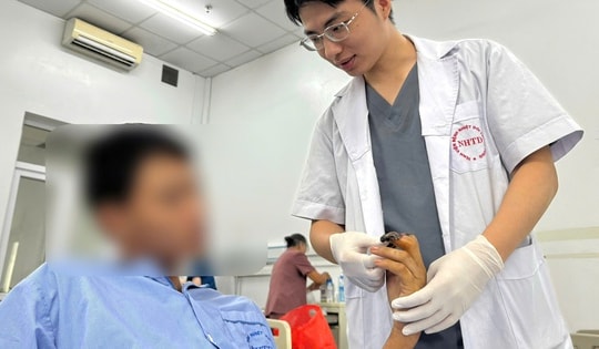 Máy cắt làm lóc da 3 ngón tay, hoại tử xương