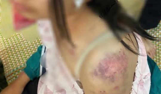 Góc pháp lý vụ bà nội bạo hành cháu gái ở Thái Nguyên