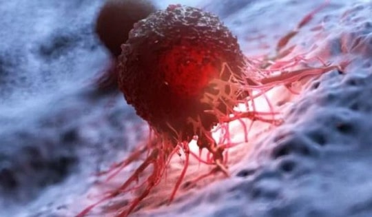 Phát hiện 'công tắc ẩn' khiến khối u kháng điều trị ung thư