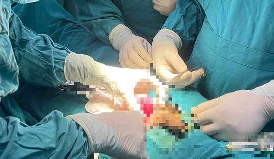 Bảo tồn thành công tinh hoàn bị xoắn cho thiếu niên đã qua 'thời gian vàng'