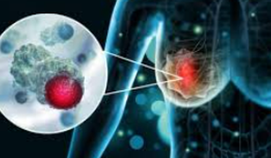 Nghiên cứu vaccine mới mở ra hy vọng chống lại ung thư vú thể nguy hiểm nhất