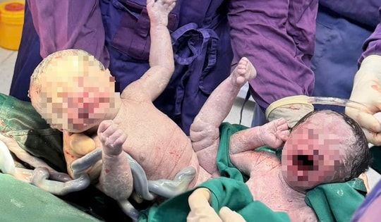 Cứu người phụ nữ bị tiền sản giật cùng 2 bé trai song sinh