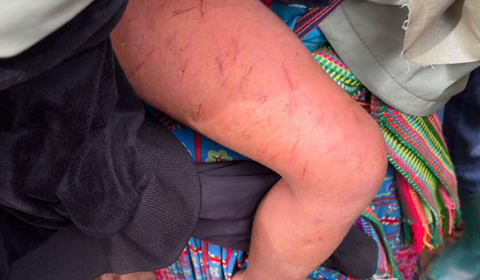 Đêm mưa rét kinh hoàng của bé 4 tuổi lạc trong rừng cao su