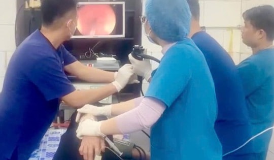 Suýt thủng thực quản vì viên thuốc