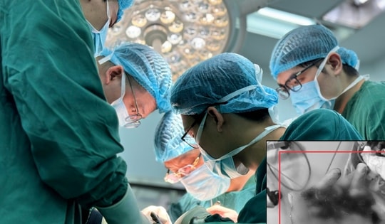 Nối thành công 4 ngón tay gần đứt rời cho bệnh nhân 25 tuổi