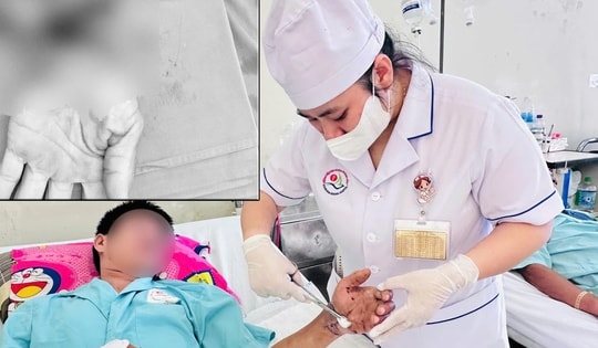 Nối thành công cổ tay đứt lìa: Ca vi phẫu 8 giờ xuyên đêm giành lại cơ thể trọn vẹn cho người bệnh