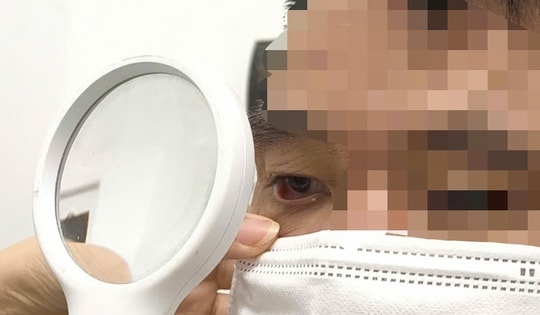 Người đàn ông bị rận mu hành hạ suốt một năm