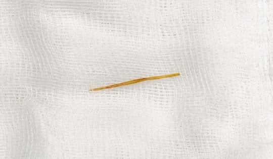 Thủng ruột do thói quen rất nhiều người mắc