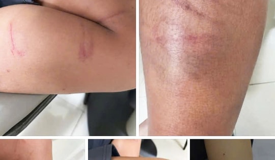 Xác minh clip người đàn ông hành hung 3 bé trai giữa đường