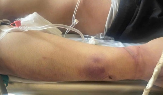 Tạm dừng trung tâm công tác xã hội có học viên tử vong sau 2 ngày nhập học