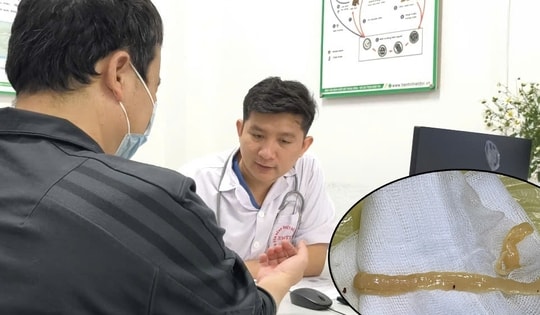 Người đàn ông hay ăn đồ sống và tiết canh, nhiễm sán dây gần 1m