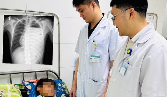 Cứu lá phổi suýt bị hủy hoại do tràn mủ màng phổi phức tạp