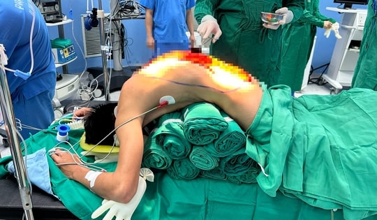 10 giờ phẫu thuật giải cứu người đàn ông 'cong như con tôm' , 7 năm cúi mặt xuống đất