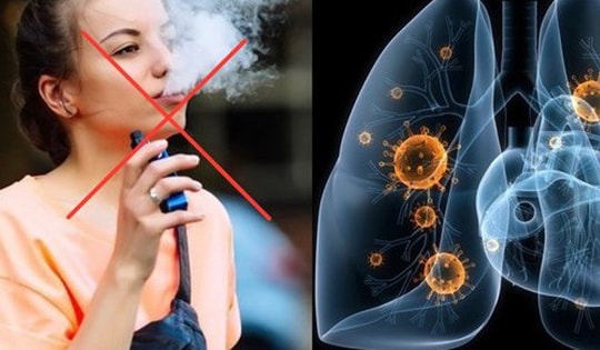 Đề xuất sửa Luật Phòng, chống tác hại của thuốc lá với nhiều quy định 'siết' thuốc lá mới