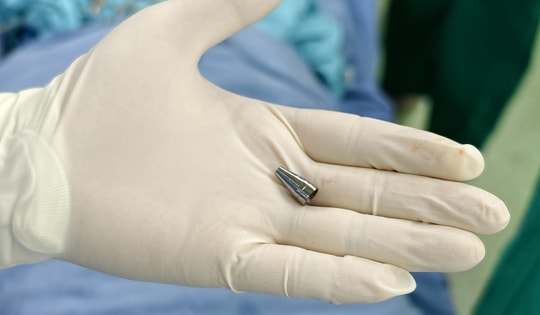 Đang ngồi học bỗng tím tái, bé trai 7 tuổi khiến bác sĩ hốt hoảng khi soi phế quản