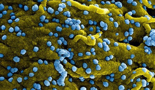 WHO: Ethiopia tuyên bố khống chế được đợt bùng phát virus Marburg