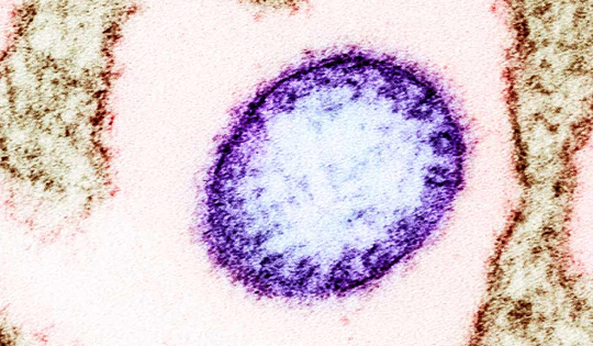 Những rào cản khiến virus Nipah chưa có vaccine