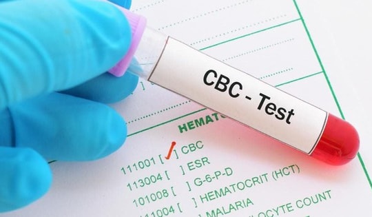 5 xét nghiệm sức khỏe quan trọng với người trên 30 tuổi