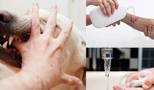 Lâm Đồng siết chặt công tác phòng, chống bệnh dại