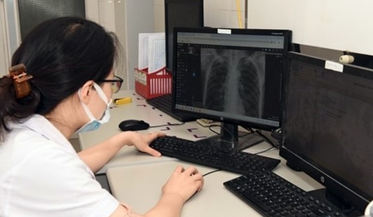 Dịch vụ chẩn đoán hình ảnh không phim được BHYT chi trả, giúp tiết kiệm, thuận tiện cho người bệnh