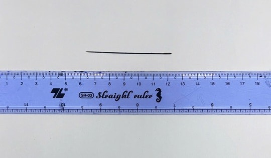 Lấy thành công kim khâu dài 6 cm nằm trong gan người đàn ông