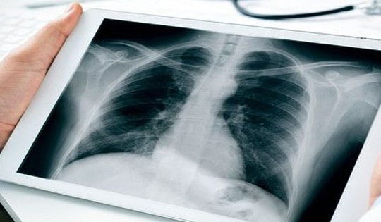 Bộ Y tế đề nghị thanh toán BHYT kỹ thuật điện quang không phụ thuộc vào thời gian chụp chiếu