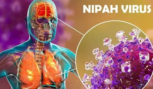 Bộ Y tế hướng dẫn giám sát và phòng bệnh do virus Nipah ở người