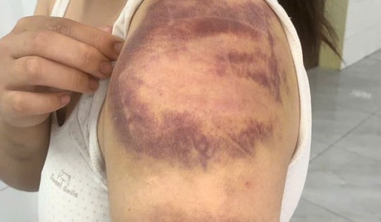 Tạm giữ người đàn ông nhiều lần đánh đập con gái và vợ đang mang thai