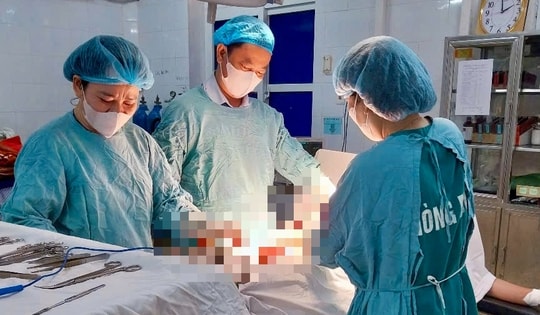 Người phụ nữ có khối u xơ tử cung to như quả bưởi