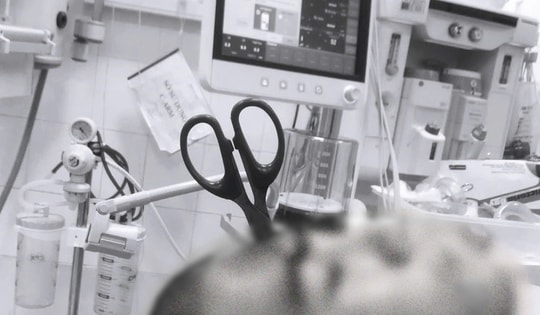 Hy hữu: Người bệnh nguy kịch do tự đâm kéo xuyên vùng đầu