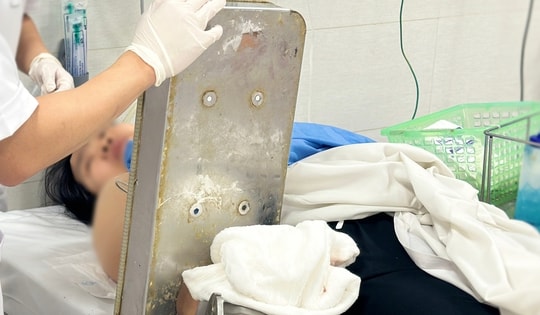 Người phụ nữ nhập viện với bàn tay vẫn còn kẹt nguyên trong máy xay thịt