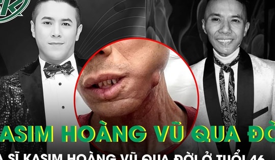Ca sĩ Kasim Hoàng Vũ qua đời ở tuổi 46 sau thời gian chống chọi bạo bệnh, hình ảnh cuối đầy xúc động