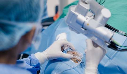 Xu hướng ghép giác mạc lớp chọn lọc bằng laser