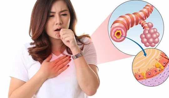 Dùng kháng sinh điều trị viêm phế quản cấp tính: Hiểu đúng để điều trị hiệu quả