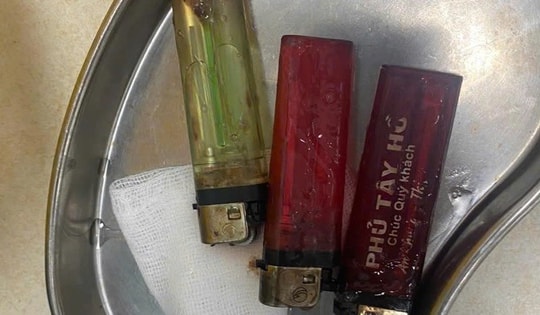 3 chiếc bật lửa trong dạ dày nam thanh niên