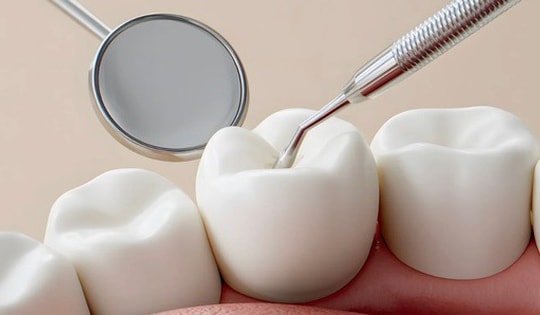 Vi phạm trong lĩnh vực y tế, 4 cơ sở nha khoa ở Lâm Đồng bị xử phạt 143 triệu đồng