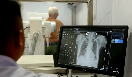 Phát hiện sớm để chặn nguồn lây bệnh lao trong cộng đồng