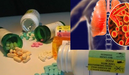 Hiểu đúng về lao kháng thuốc