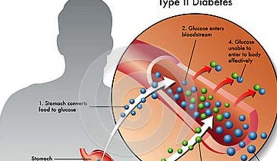Loại thuốc trị đái tháo đường mới vừa kiểm soát đường huyết, vừa hỗ trợ giảm cân